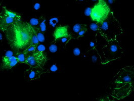 PDLIM2 Antibody in Immunocytochemistry (ICC/IF)