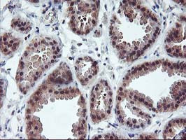 PDLIM2 Antibody in Immunohistochemistry (Paraffin) (IHC (P))