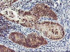 PDLIM2 Antibody in Immunohistochemistry (Paraffin) (IHC (P))