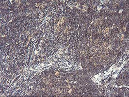 PDLIM2 Antibody in Immunohistochemistry (Paraffin) (IHC (P))