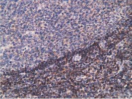 PDLIM2 Antibody in Immunohistochemistry (Paraffin) (IHC (P))