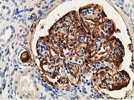 PDLIM2 Antibody in Immunohistochemistry (Paraffin) (IHC (P))