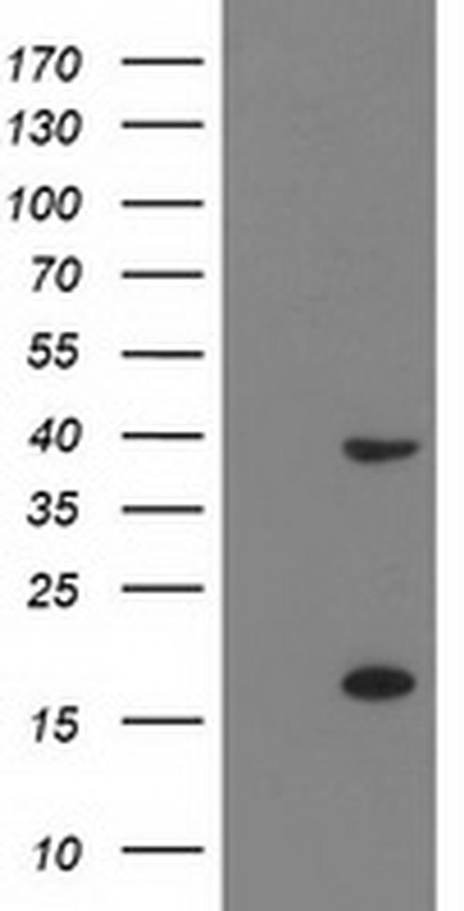 PDLIM2 Antibody in Western Blot (WB)