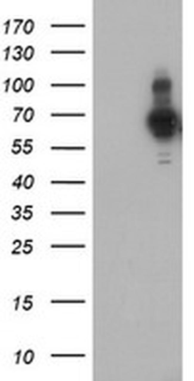 PDLIM5 Antibody in Western Blot (WB)