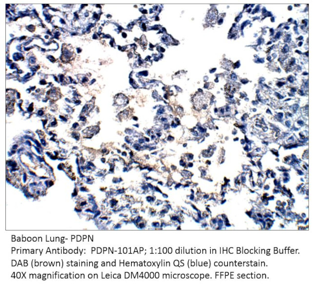 Podoplanin Antibody in Immunohistochemistry (IHC)