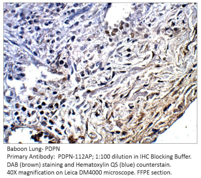 Podoplanin Antibody in Immunohistochemistry (IHC)