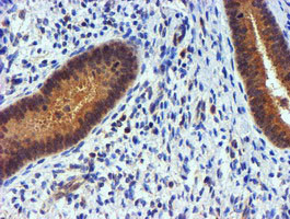 PDSS2 Antibody in Immunohistochemistry (Paraffin) (IHC (P))