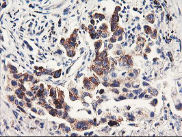 PDSS2 Antibody in Immunohistochemistry (Paraffin) (IHC (P))