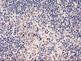 PDSS2 Antibody in Immunohistochemistry (Paraffin) (IHC (P))