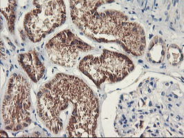 PDSS2 Antibody in Immunohistochemistry (Paraffin) (IHC (P))