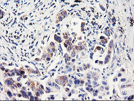 PDSS2 Antibody in Immunohistochemistry (Paraffin) (IHC (P))