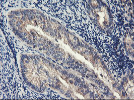 PDSS2 Antibody in Immunohistochemistry (Paraffin) (IHC (P))