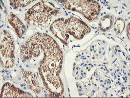 PDSS2 Antibody in Immunohistochemistry (Paraffin) (IHC (P))