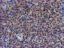 PDSS2 Antibody in Immunohistochemistry (Paraffin) (IHC (P))