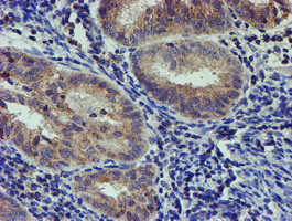 PDSS2 Antibody in Immunohistochemistry (Paraffin) (IHC (P))