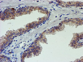 PDSS2 Antibody in Immunohistochemistry (Paraffin) (IHC (P))