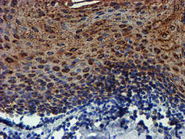 PDSS2 Antibody in Immunohistochemistry (Paraffin) (IHC (P))