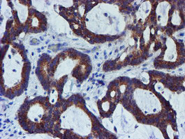 PDSS2 Antibody in Immunohistochemistry (Paraffin) (IHC (P))