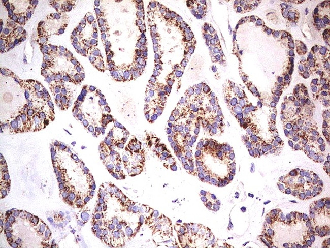 PDSS2 Antibody in Immunohistochemistry (Paraffin) (IHC (P))