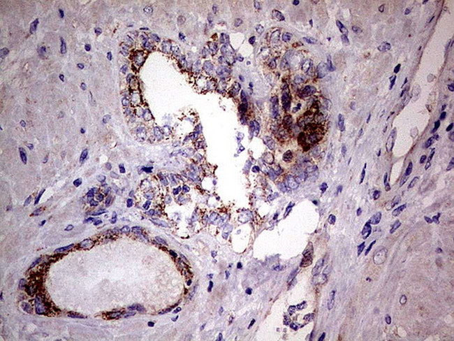 PDSS2 Antibody in Immunohistochemistry (Paraffin) (IHC (P))