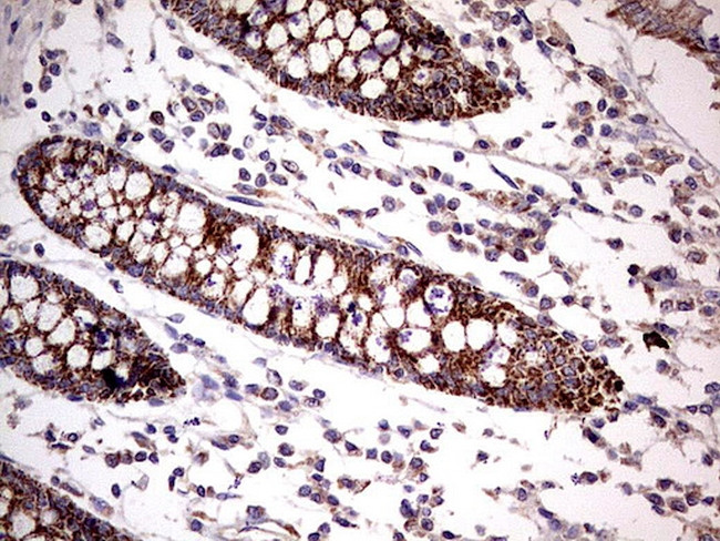 PDSS2 Antibody in Immunohistochemistry (Paraffin) (IHC (P))