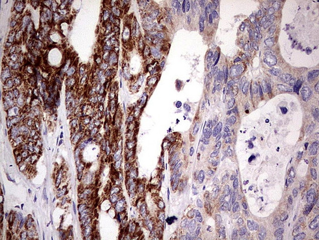 PDSS2 Antibody in Immunohistochemistry (Paraffin) (IHC (P))