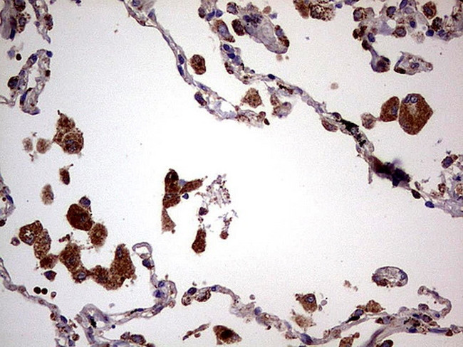 PDSS2 Antibody in Immunohistochemistry (Paraffin) (IHC (P))