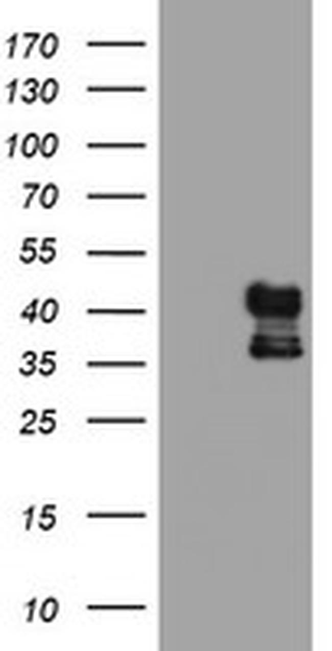 PDSS2 Antibody in Western Blot (WB)