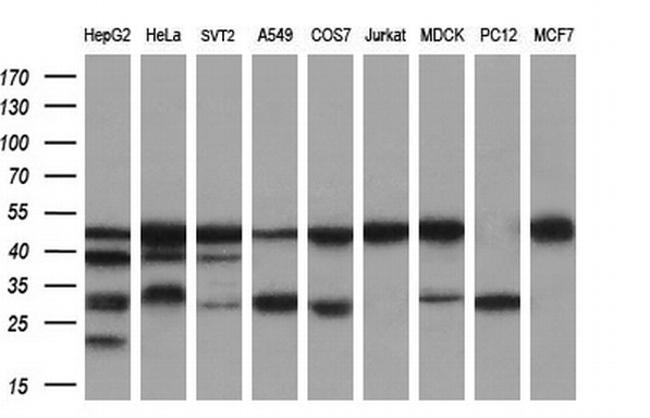 PDSS2 Antibody in Western Blot (WB)