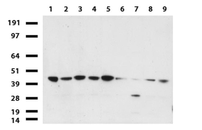 PDSS2 Antibody in Western Blot (WB)