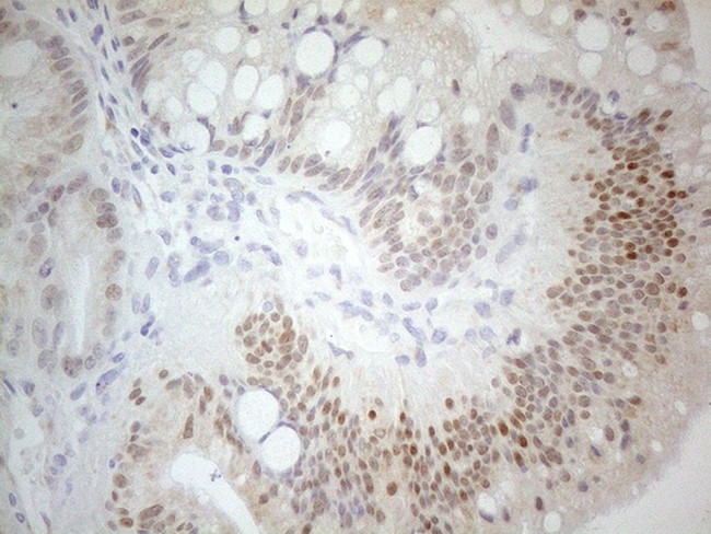 PDX1 Antibody in Immunohistochemistry (Paraffin) (IHC (P))