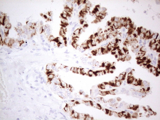 PDX1 Antibody in Immunohistochemistry (Paraffin) (IHC (P))