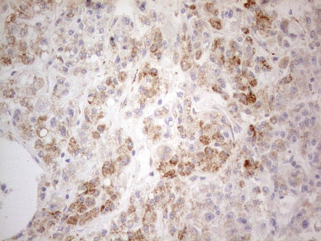 PDX1 Antibody in Immunohistochemistry (Paraffin) (IHC (P))