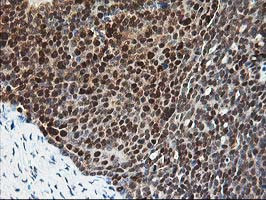 PDXK Antibody in Immunohistochemistry (Paraffin) (IHC (P))