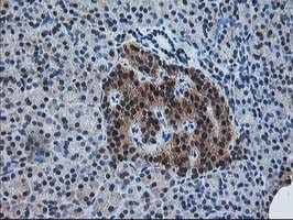 PDXK Antibody in Immunohistochemistry (Paraffin) (IHC (P))