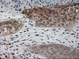 PDXK Antibody in Immunohistochemistry (Paraffin) (IHC (P))