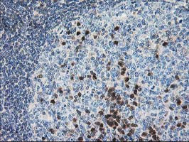 PDXK Antibody in Immunohistochemistry (Paraffin) (IHC (P))