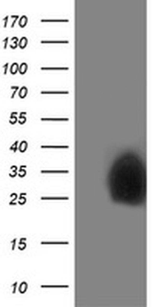 PDXK Antibody in Western Blot (WB)