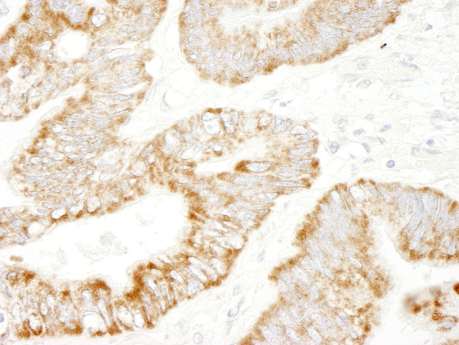 PDZ-GEF1 Antibody in Immunohistochemistry (IHC)