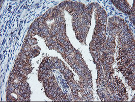 PECI Antibody in Immunohistochemistry (Paraffin) (IHC (P))