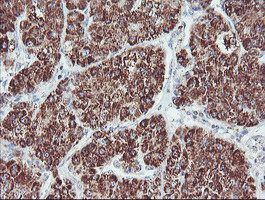 PECI Antibody in Immunohistochemistry (Paraffin) (IHC (P))