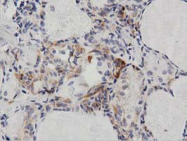 PECR Antibody in Immunohistochemistry (Paraffin) (IHC (P))