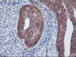 PECR Antibody in Immunohistochemistry (Paraffin) (IHC (P))