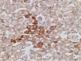 PECR Antibody in Immunohistochemistry (Paraffin) (IHC (P))