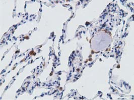 PECR Antibody in Immunohistochemistry (Paraffin) (IHC (P))