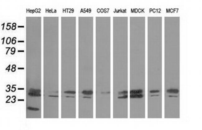 PECR Antibody in Western Blot (WB)