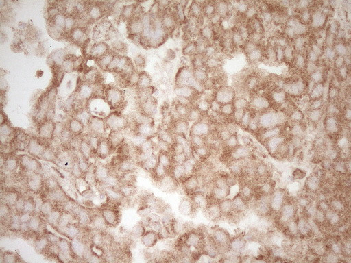 PELI1 Antibody in Immunohistochemistry (Paraffin) (IHC (P))