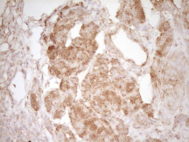 PELI1 Antibody in Immunohistochemistry (Paraffin) (IHC (P))