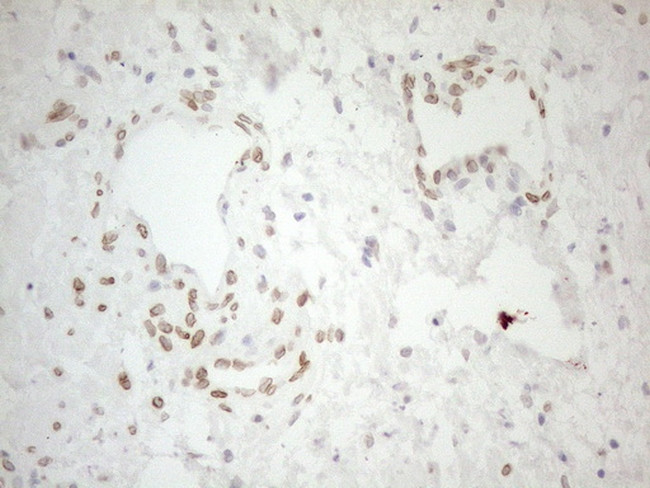 PELI1 Antibody in Immunohistochemistry (Paraffin) (IHC (P))