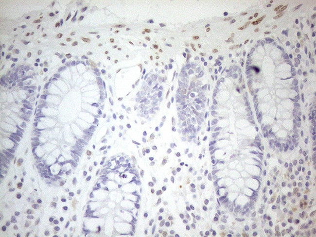 PELI1 Antibody in Immunohistochemistry (Paraffin) (IHC (P))